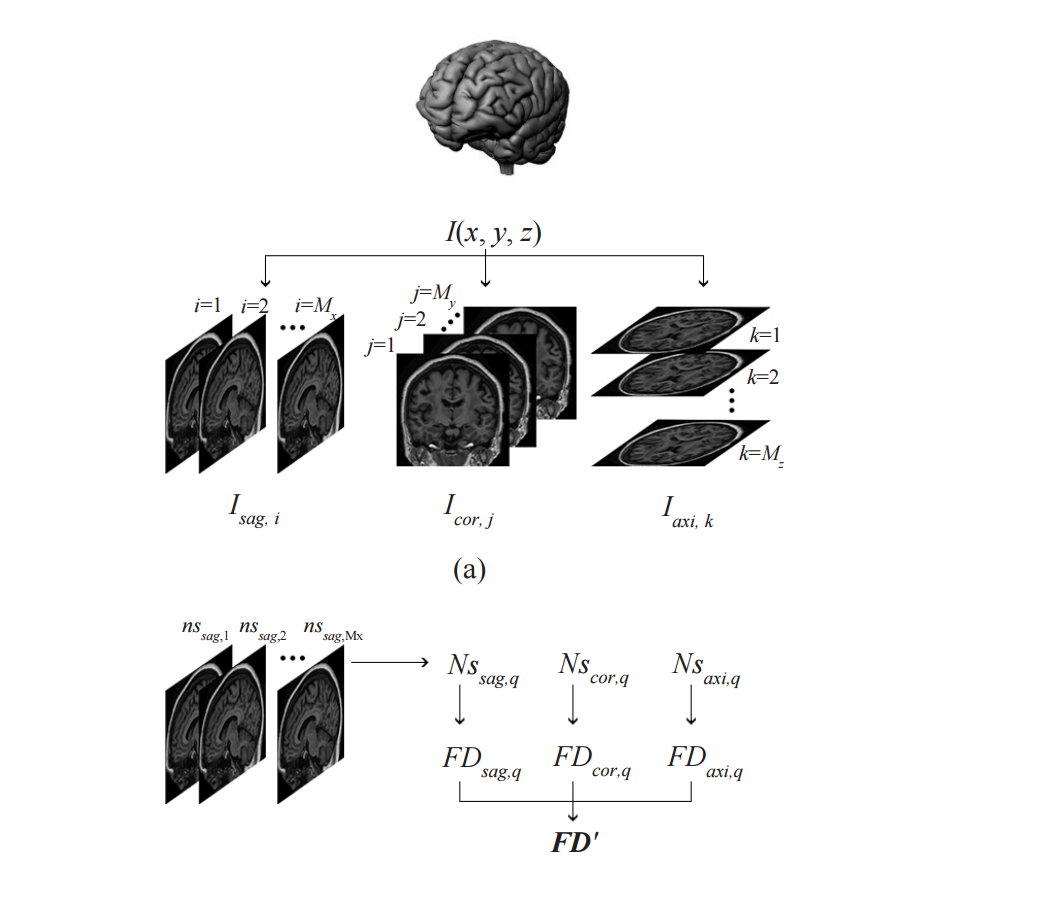 fractal-dimension-for-classifying-3d-brain-mri-using-improved-triangle